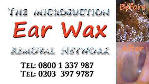 Microsuction EarWax Removal Clinic Welwyn Garden City photo